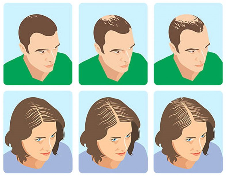 Pin on hair styles