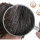 What is dandruff? What types of dandruff are there?