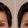 Catalasa, imprescindible para frenar las canas
