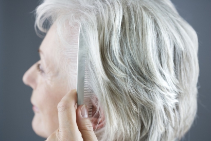 WHAT IS FEMALE ALOPECIA FOR AGING AND HOW TO TREAT IT?