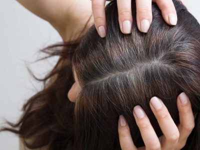 ¿Por qué salen canas siendo joven? Principales causas y cómo frenar su avance