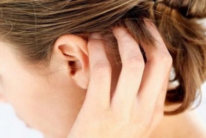 What are the causes of itching of the scalp?
