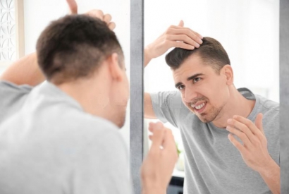 REMEDIES FOR BALDNESS IN TEENAGERS