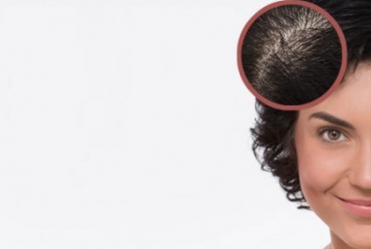 LA PERTE DE CHEVEUX DANS LA MÉNOPAUSE - LES REMÈDES ET LES SOLUTIONS