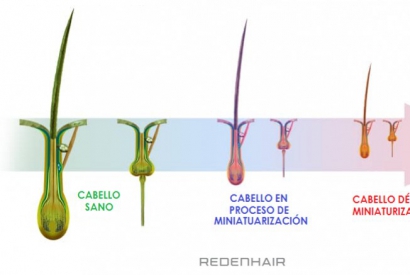 ¿Qué es la miniaturización del cabello?